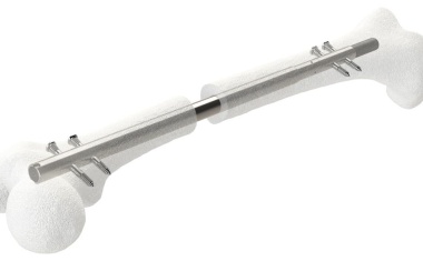 Evonik verkauft Synoste-Beteiligung an Globus Medical