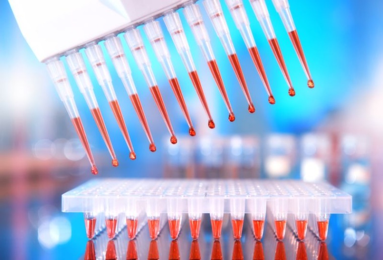 © tilialucida - stock.adobe.com