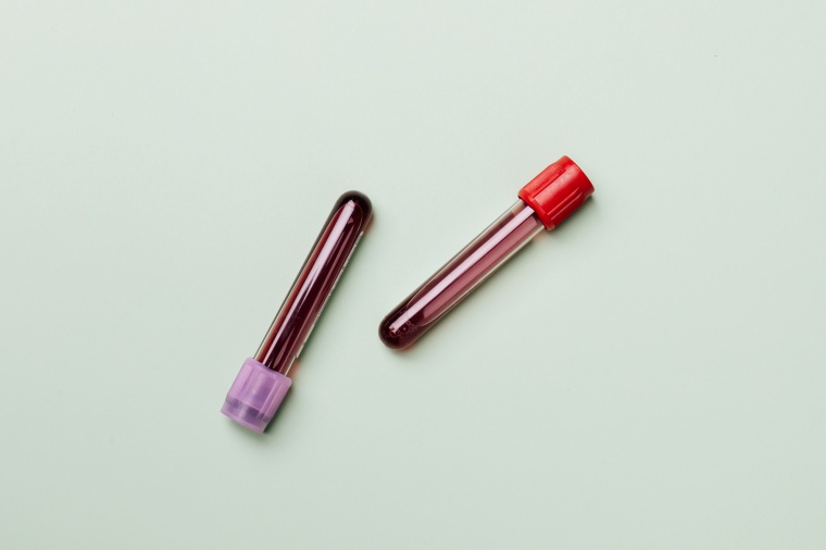 The FDA’s emergency authorization of blood plasma infusions for Covid-19...